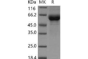 Western Blotting (WB) image for Cellular Repressor of E1A-Stimulated Genes 1 (CREG1) protein (Fc Tag) (ABIN7320061) (CREG1 Protein (Fc Tag))
