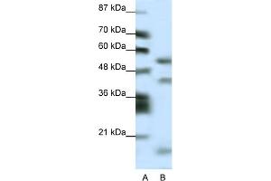WB Suggested Anti-LHX1 Antibody Titration:  0. (LHX1 antibody  (N-Term))