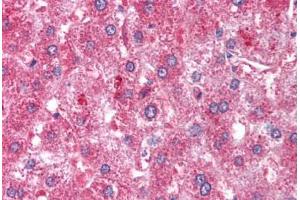 Human Liver (formalin-fixed, paraffin-embedded) stained with ATM antibody ABIN213900 at 1-2 ug/ml followed by biotinylated goat anti-rabbit IgG secondary antibody ABIN481713, alkaline phosphatase-streptavidin and chromogen. (ATM antibody  (C-Term))