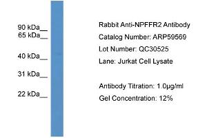 WB Suggested Anti-NPFFR2  Antibody Titration: 0. (NPFFR2 antibody  (Middle Region))