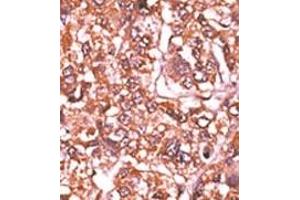 Image no. 2 for anti-Retinoblastoma 1 (RB1) (pSer612) antibody (ABIN358212) (Retinoblastoma 1 antibody  (pSer612))