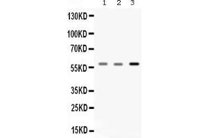 Western blot analysis of Catalase expression in rat skeletal muscle extract ( Lane 1), mouse skeletal muscle extract ( Lane 2) and A549 whole cell lysates ( Lane 3). (Catalase antibody  (AA 344-527))