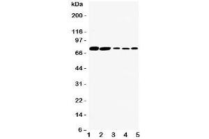 Western blot testing of SGLT1 antibody and Lane 1:  rat kidney;  2: (r) heart;  3: human HeLa;  4: (h) SW620;  5: (h) COLO320 cell lysate. (SLC5A1 antibody  (C-Term))