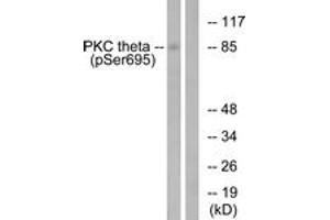 Western blot analysis of extracts from Jurkat cells treated with EGF 200ng/ml 15', using PKC thet (Phospho-Ser695) Antibody. (PKC theta antibody  (pSer695))
