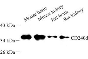 RHD antibody