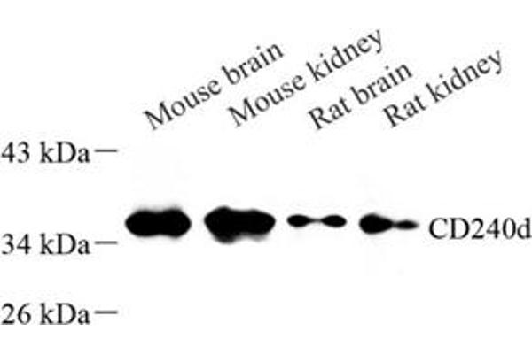 RHD antibody