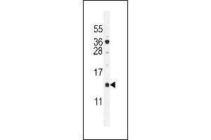 SFT2D2 Antibody (N-term) (ABIN655101 and ABIN2844733) western blot analysis in  cell line lysates (35 μg/lane). (SFT2D2 antibody  (N-Term))