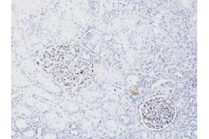 Immunohistochemical staining (Formalin-fixed paraffin-embedded sections) of human kidney with WT1 recombinant monoclonal antibody, clone WT1/1434R . (Recombinant WT1 antibody)