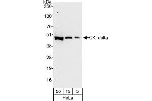 Western Blotting (WB) image for anti-Casein Kinase 1, delta (CSNK1D) (AA 359-409) antibody (ABIN7451708)