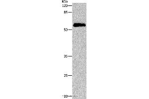Western blot analysis of Human cervical cancer tissue, using CDC20 Polyclonal Antibody at dilution of 1:600 (CDC20 antibody)