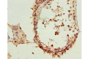 Immunohistochemistry of paraffin-embedded human testis tissue using ABIN7172454 at dilution of 1:100 (TCF19 antibody  (AA 1-290))