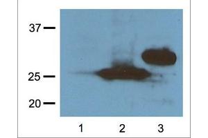 1:1000 (1μg/mL) Ab dilution probed against HEK293 cells transfected with RFP-tagged protein vector, untransfected control (1), transfected with Turbo-RFP (2), and transfected with DeRed (3) (RFP antibody  (N-Term))