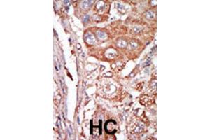 Immunohistochemistry (IHC) image for anti-Fibroblast Growth Factor 4 (FGF4) antibody (ABIN3003719)