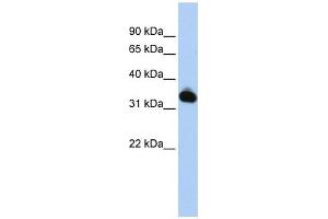 GALM antibody used at 1 ug/ml to detect target protein.
