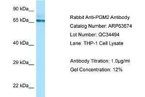 Western Blotting (WB) image for anti-Phosphoglucomutase 2 (PGM2) (C-Term) antibody (ABIN2774378)