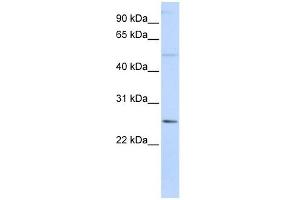 FTHL17 antibody used at 1 ug/ml to detect target protein. (FTHL17 antibody  (N-Term))