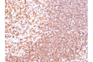 Formalin-fixed, paraffin-embedded human Tonsil stained with CD74 Ab (SPM523).