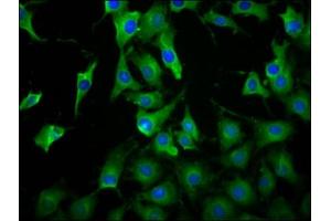 Immunofluorescence staining of NIH/3T3 cells with ABIN7158272 at 1:100, counter-stained with DAPI. (LILRB3 antibody  (AA 470-624))
