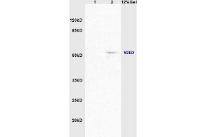 Lane 1: mouse brain lysates Lane 2: mouse heart lysates probed with Anti ACTRIC/Activin A Receptor Type IC Polyclonal Antibody, Unconjugated (ABIN714596) at 1:200 in 4 °C. (ACVR1C/ALK7 antibody  (AA 21-120))