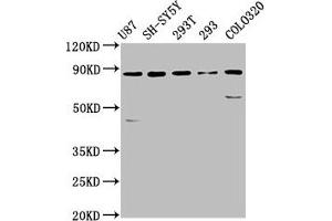 Western Blot Positive WB detected in: U87 whole cell lysate, SH-SY5Y whole cell lysate, 293T whole cell lysate, 293 whole cell lysate, Colo320 whole cell lysate All lanes: SLC26A4 antibody at 5.