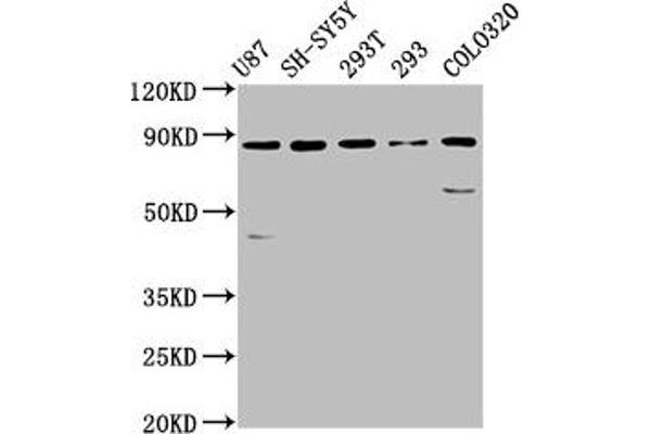 SLC26A4 anticorps  (AA 592-655)