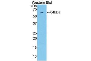 Western Blotting (WB) image for anti-Matrix Metalloproteinase 2 (MMP2) (AA 110-660) antibody (ABIN1859851) (MMP2 antibody  (AA 110-660))