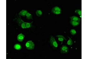 Immunofluorescent analysis of MCF-7 cells using ABIN7154703 at dilution of 1:100 and Alexa Fluor 488-congugated AffiniPure Goat Anti-Rabbit IgG(H+L) (GNAQ antibody  (AA 1-359))