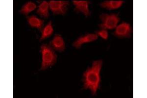 ABIN6275824 staining Hela by IF/ICC. (CYP20A1 antibody  (Internal Region))