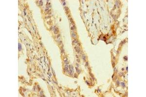 Immunohistochemistry of paraffin-embedded human pancreatic cancer using ABIN7162135 at dilution of 1:100 (OBP2A antibody  (AA 16-170))
