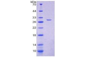 SDS-PAGE (SDS) image for Glutamyl Aminopeptidase (Aminopeptidase A) (ENPEP) (AA 409-624) protein (His tag) (ABIN2124992)