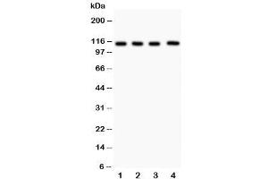 Western blot testing of Neuropilin 1 antibody and Lane 1:  (h) U87 (Neuropilin 1 antibody  (AA 504-827))