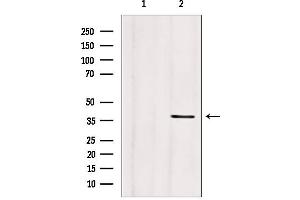 Western blot analysis of extracts from mouse brain, using CLTA antibody.