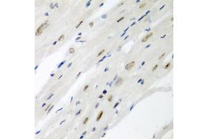 Immunohistochemistry of paraffin-embedded mouse heart using CDC27 antibody (ABIN3015756, ABIN3015757, ABIN1679113 and ABIN6219104) at dilution of 1:200 (40x lens). (CDC27 antibody  (AA 551-830))