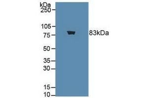 Detection of ChAT in Rat Brain Tissue using Polyclonal Antibody to Choline Acetyltransferase (ChAT) (Choline Acetyltransferase antibody  (AA 517-732))