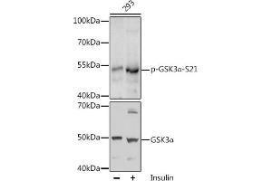 Western blot analysis of extracts of 293 cells, using Phospho-GSK3α-S21 antibody (ABIN6135231, ABIN6136096, ABIN6136097 and ABIN6225606) at 1:1000 dilution or GSK3α antibody (ABIN1680131, ABIN3015275, ABIN3015276 and ABIN6213918). (GSK3 alpha antibody  (pSer21))