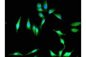 Immunofluorescent analysis of Hela cells using ABIN7152863 at dilution of 1:100 and Alexa Fluor 488-congugated AffiniPure Goat Anti-Rabbit IgG(H+L) (PKHD1 antibody  (AA 520-743))