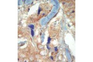 Immunohistochemistry (Paraffin-embedded Sections) (IHC (p)) image for anti-Fms-Related tyrosine Kinase 3 (FLT3) (N-Term) antibody (ABIN359868)