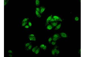 Immunofluorescence staining of HepG2 cells with ABIN7153038 at 1:166, counter-stained with DAPI. (FOXE3 antibody  (AA 4-74))