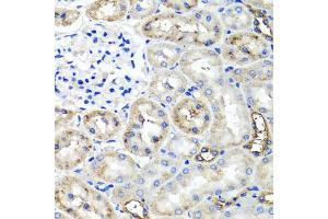 Immunohistochemistry of paraffin-embedded rat kidney using TNFAIP6 antibody (ABIN5975410) at dilution of 1/100 (40x lens). (TNFAIP6 antibody)