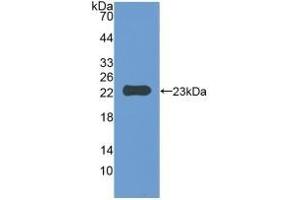 Detection of Recombinant IAP, Mouse using Polyclonal Antibody to Integrin Associated Protein (IAP)