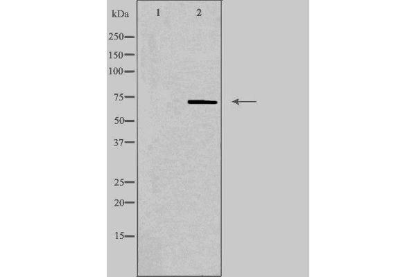 PLA2G4C antibody  (Internal Region)