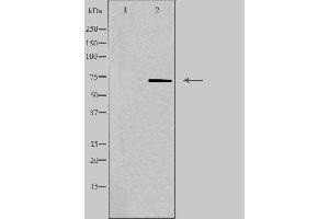 Western blot analysis of extracts from Jurkat cells, using PLA2G4C antibody.