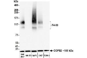 Western Blotting (WB) image for anti-Egf-Like Module Containing, Mucin-Like, Hormone Receptor-Like 1 (EMR1) (AA 28-225) antibody (ABIN7455124)