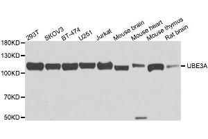 Western blot analysis of extracts of various cell lines, using UBE3A antibody. (ube3a antibody  (AA 300-590))