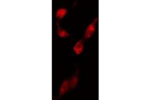 ABIN6274210 staining 293 cells by IF/ICC.