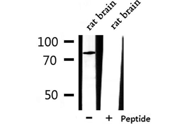 CLCN3 antibody  (N-Term)