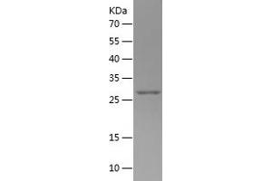 Western Blotting (WB) image for Galectin 3 (LGALS3) (AA 4-262) protein (His tag) (ABIN7123044) (Galectin 3 Protein (LGALS3) (AA 4-262) (His tag))