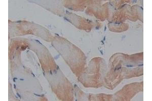 Immunohistochemistry (IHC) image for anti-Regenerating Islet-Derived 3 beta (REG3B) (AA 27-175) antibody (ABIN7441622)
