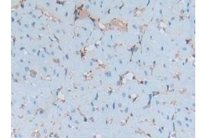 Detection of S100A6 in Rat Heart Tissue using Polyclonal Antibody to S100 Calcium Binding Protein A6 (S100A6) (S100A6 antibody  (AA 1-89))
