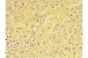 Immunohistochemistry of paraffin-embedded human liver tissue using ABIN7143385 at dilution of 1:100 (F4/80 antibody  (AA 21-290))